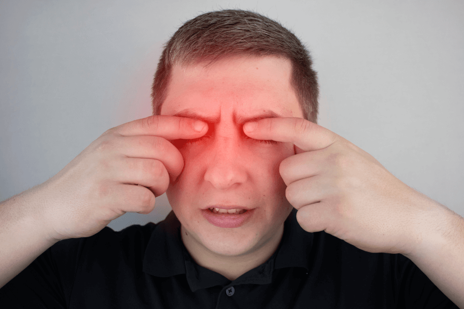 How to Get Rid of Red Eyes From Weed